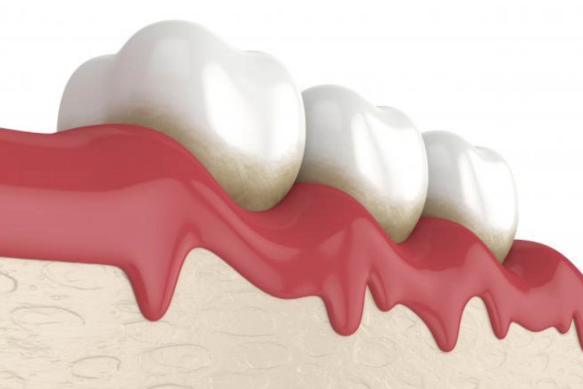 Alla base della ricerca c’è un composto chimico sviluppato presso l’Istituto Fraunhofer per la Terapia Cellulare e l'Immunologia di Halle.